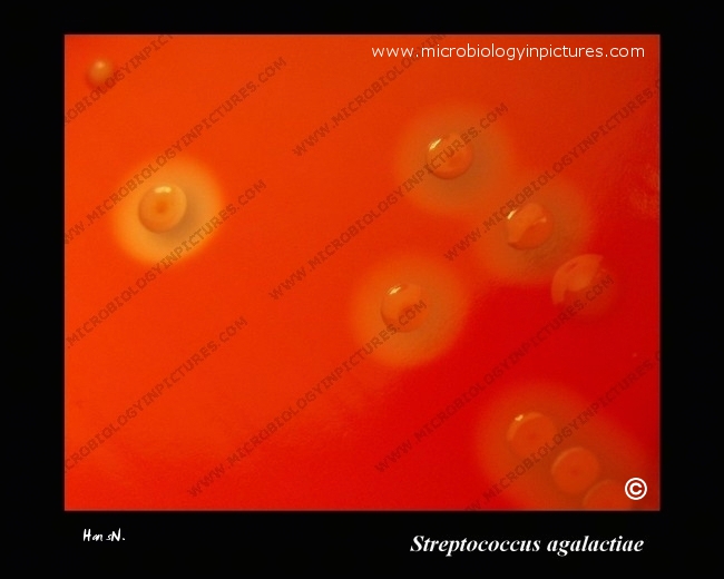 streptococcus agalactiae morphology and complete hemolysis